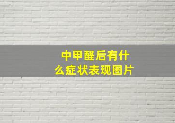 中甲醛后有什么症状表现图片