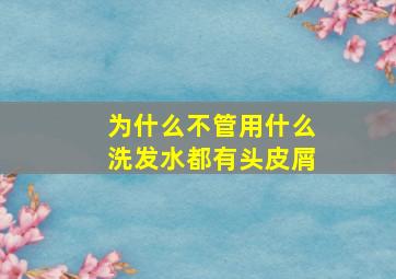 为什么不管用什么洗发水都有头皮屑