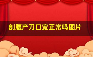 剖腹产刀口宽正常吗图片