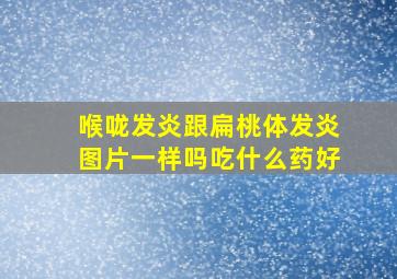 喉咙发炎跟扁桃体发炎图片一样吗吃什么药好