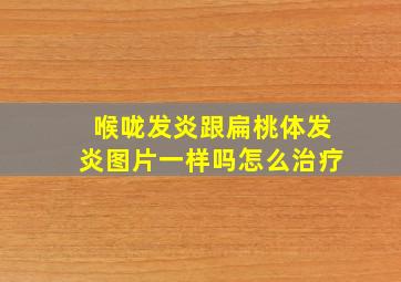 喉咙发炎跟扁桃体发炎图片一样吗怎么治疗