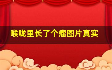 喉咙里长了个瘤图片真实