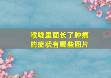 喉咙里面长了肿瘤的症状有哪些图片