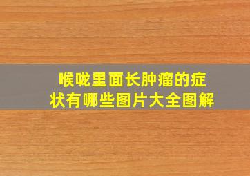 喉咙里面长肿瘤的症状有哪些图片大全图解