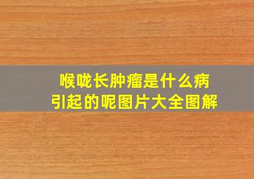 喉咙长肿瘤是什么病引起的呢图片大全图解