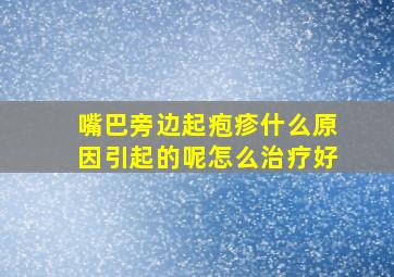 嘴巴旁边起疱疹什么原因引起的呢怎么治疗好