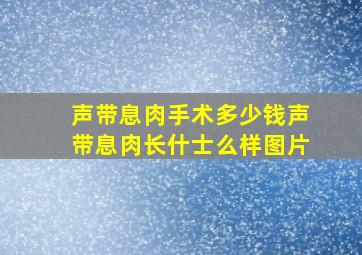 声带息肉手术多少钱声带息肉长什士么样图片