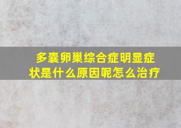 多囊卵巢综合症明显症状是什么原因呢怎么治疗