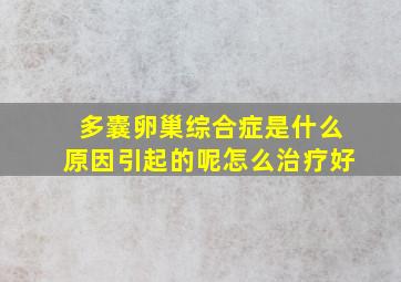 多囊卵巢综合症是什么原因引起的呢怎么治疗好