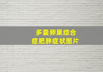 多囊卵巢综合症肥胖症状图片