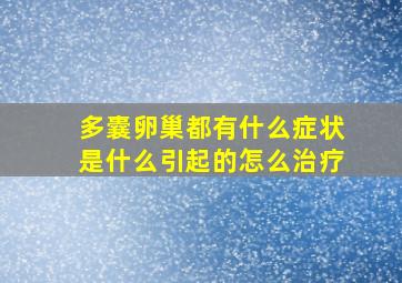 多囊卵巢都有什么症状是什么引起的怎么治疗