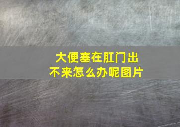 大便塞在肛门出不来怎么办呢图片