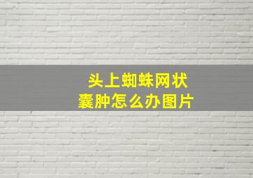 头上蜘蛛网状囊肿怎么办图片