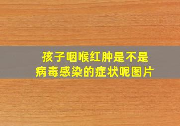 孩子咽喉红肿是不是病毒感染的症状呢图片