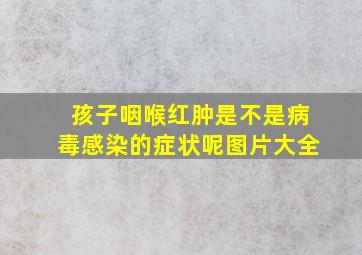 孩子咽喉红肿是不是病毒感染的症状呢图片大全