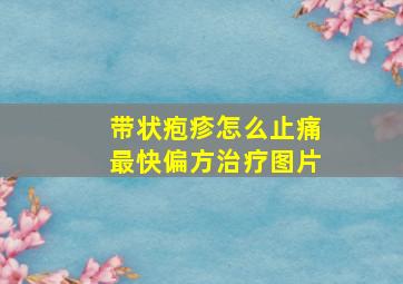 带状疱疹怎么止痛最快偏方治疗图片