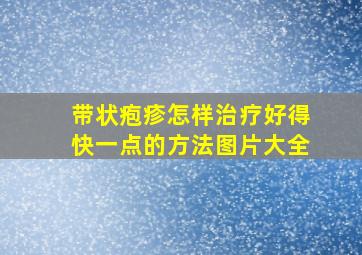 带状疱疹怎样治疗好得快一点的方法图片大全