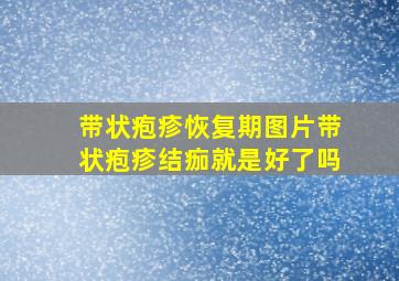 带状疱疹恢复期图片带状疱疹结痂就是好了吗