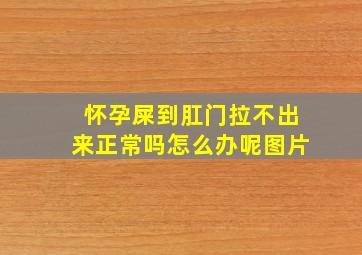 怀孕屎到肛门拉不出来正常吗怎么办呢图片