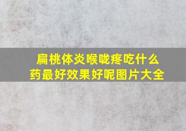 扁桃体炎喉咙疼吃什么药最好效果好呢图片大全