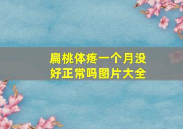 扁桃体疼一个月没好正常吗图片大全