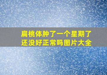 扁桃体肿了一个星期了还没好正常吗图片大全