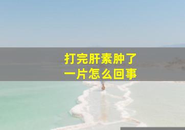 打完肝素肿了一片怎么回事