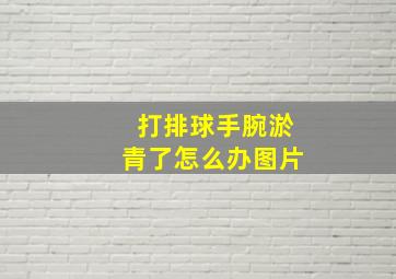 打排球手腕淤青了怎么办图片