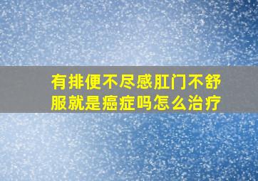 有排便不尽感肛门不舒服就是癌症吗怎么治疗