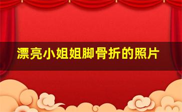 漂亮小姐姐脚骨折的照片