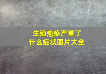 生殖疱疹严重了什么症状图片大全