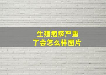 生殖疱疹严重了会怎么样图片