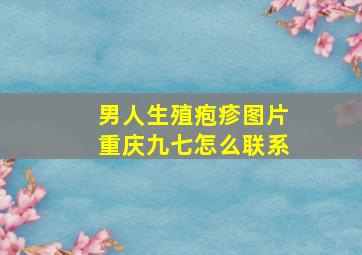 男人生殖疱疹图片重庆九七怎么联系