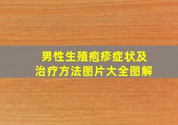 男性生殖疱疹症状及治疗方法图片大全图解