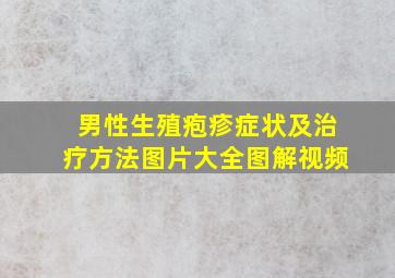 男性生殖疱疹症状及治疗方法图片大全图解视频