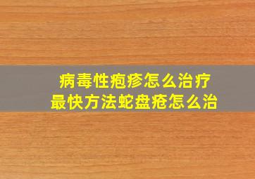 病毒性疱疹怎么治疗最快方法蛇盘疮怎么治