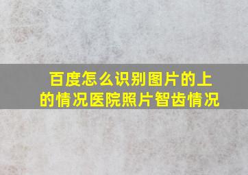 百度怎么识别图片的上的情况医院照片智齿情况