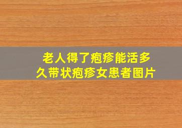 老人得了疱疹能活多久带状疱疹女患者图片