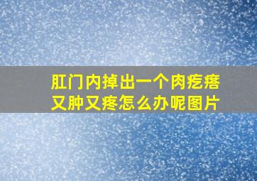 肛门内掉出一个肉疙瘩又肿又疼怎么办呢图片