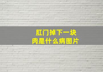 肛门掉下一块肉是什么病图片