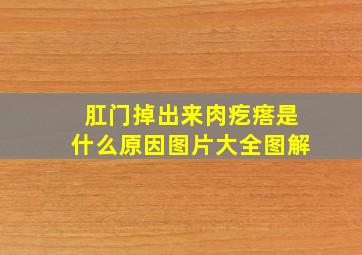 肛门掉出来肉疙瘩是什么原因图片大全图解