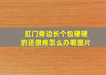 肛门旁边长个包硬硬的还很疼怎么办呢图片