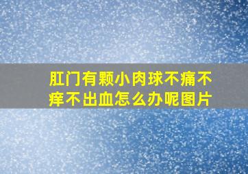 肛门有颗小肉球不痛不痒不出血怎么办呢图片