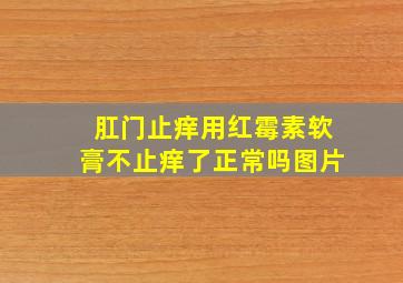 肛门止痒用红霉素软膏不止痒了正常吗图片