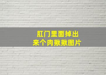 肛门里面掉出来个肉揪揪图片