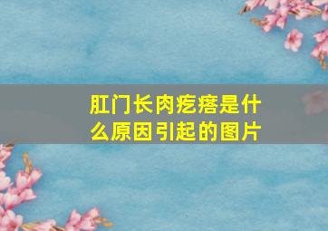 肛门长肉疙瘩是什么原因引起的图片