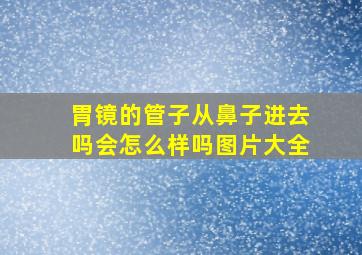 胃镜的管子从鼻子进去吗会怎么样吗图片大全