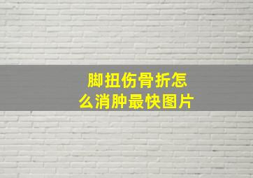 脚扭伤骨折怎么消肿最快图片