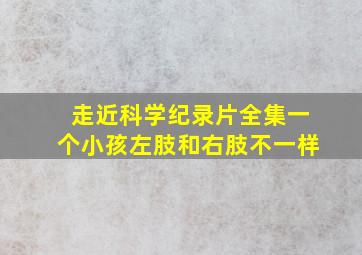 走近科学纪录片全集一个小孩左肢和右肢不一样