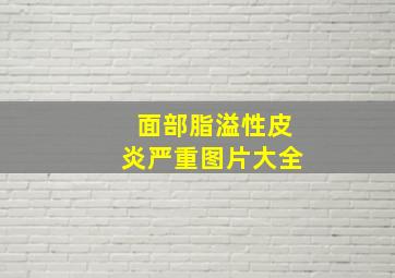 面部脂溢性皮炎严重图片大全